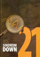 Sindrom Down