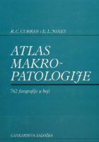 Atlas makropatologije