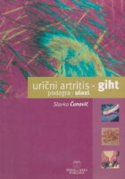 Urični artritis - giht