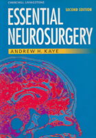 Essential Neurosurgery