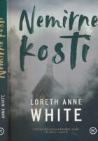 Nemirne kosti
